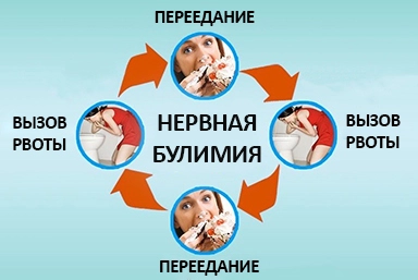Лечение булимии в Стародубе